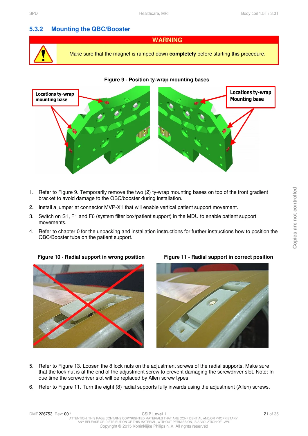 Philips Achieva Multiva Ingenia CX MRI Body Coil 1.5T 3.0T Service Procedures PDF Download - Image 3