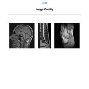 Philips MRI Image Quality Troubleshooting Spike RF Noise Artifact Diagnostic Manual DMR 193227 PDF Download